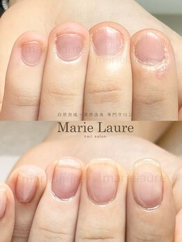 マリーロール 淀屋橋本店(Marie Laure)/自爪育成/深爪矯正/ネイルケア