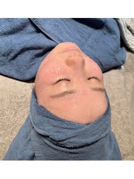 ベルフィーヌ(belfine)/2 &nbsp;高濃度炭酸パック