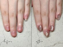 ユユネイル(yuyu nail)/【深爪育成】長さ出し＋アート
