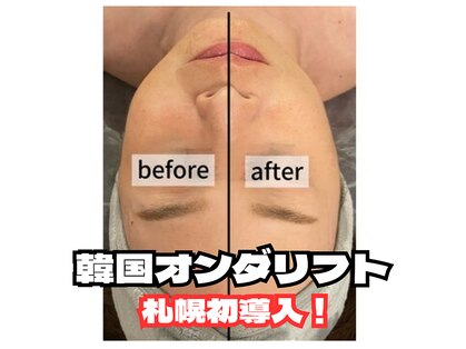 ディア(Deer)の写真