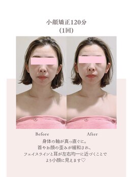 トゥインクル 麻布(twinkle)/港区南麻布/白金高輪/小顔矯正