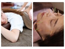 カナヤ鍼灸整骨院/1日１名様限定のクーポン♪