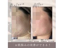モアトゥインクル 福山宮通り店(MORE twinkle)