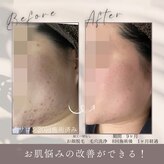 モアトゥインクル 福山宮通り店(MORE twinkle)