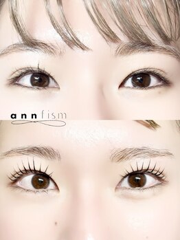 アンフィズム(annfism)/