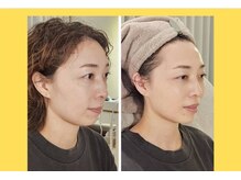 アン 銀座(ann)/レモンボトルでキュンキュン