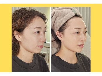 アン 銀座(ann)/レモンボトルでキュンキュン