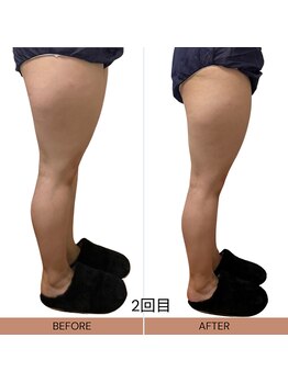 ママニエ(ma maniere)/美脚美尻コース