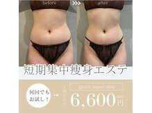 1回で実感！【痩身エステ】 都度払い、定額プランもあります♪