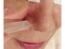 A&A 小山VAL店/毛穴吸引ケア