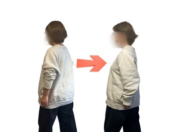 シゼン(Shizen)/ビフォーアフター