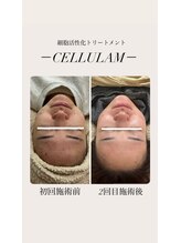 リバイセリー(Revicelly)/2回目の変化