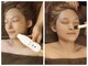 ドクタースタイル(Dr.style)の写真/ニキビ・肌トラブルケアにも◎【まずはお試し】毛穴洗浄+小顔リンパ+コルギ幹細胞美容液60分¥6980