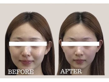 アリュールビューティー 下高井戸店(ALLURE BEAUTY)の写真/歪み、たるみ、むくみ改善！ハリ弾力UP