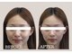 アリュールビューティー 下高井戸店(ALLURE BEAUTY)の写真/歪み、たるみ、むくみ改善！ハリ弾力UP