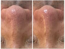 シャイネル(SHYNELL)の雰囲気(ニギビや毛穴ケアにも特化。男性にもオススメ☆)