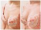 エステティックステラ(esthetic stella)の写真