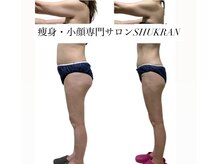 シュクラン(SHUKRAN)