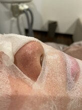アイシア(Isia)/毛穴特殊エクスフォリエーション