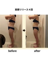 クリア(Clear)/筋膜リリース