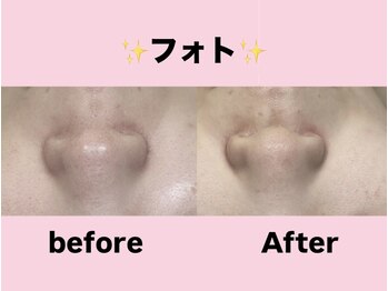 エステティック　レイビス 渋谷店(RAYVIS)/フォト