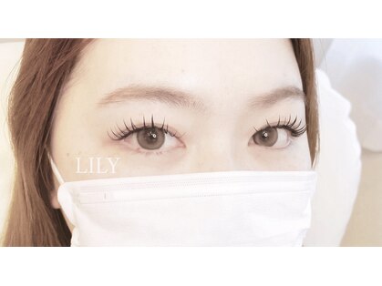 リリー(LILY)の写真