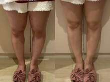 ルーナジェーナ(Luna llena)/脚の浮腫は足裏から！