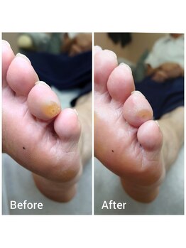 リゼラアンドコー 神戸店/