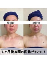お顔の研究所/ビフォーアフター写真♪