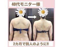 スワン 新栄店(SWAN)/40代モニター様/まるで別人？？