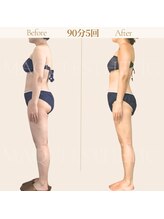 マクイエステティック 表参道店/40代ビフォーアフター