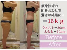 クリニカルエステ/イーズ 六甲アイランド店