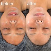 四季ビューティー(四季beauty)