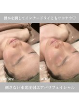 エステサロン ジュエル 高松レインボー店(JEWEL)/エアバリフェイシャル