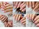 ファストネイル(FAST NAIL)の写真