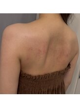 美温(mion)/ブライダルエステ　3回目