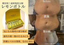 カラーリリー(calla lily)