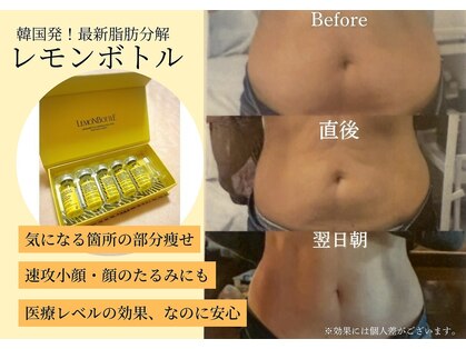 カラーリリー(calla lily)の写真