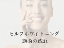 ホワイト 福岡博多店(WHITE)/セルフホワイトニング施術の流れ
