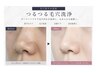 【6月限定】毛穴黒ずみ改善｜つるつる毛穴洗浄 ¥19,800→¥9,900