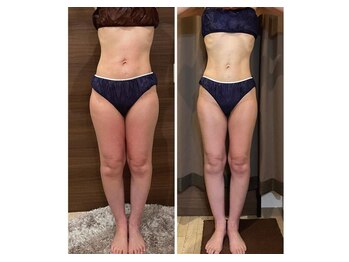 エステサロン 美飾り イオンモール木更津店/before⇒after/美脚痩身