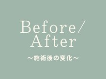 ピース/ビフォーアフター