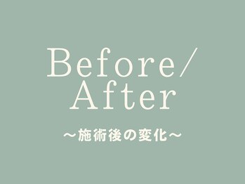 ピース/ビフォーアフター