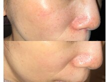 ル シーニュ/オーダーメイドフェイシャル