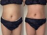 【人気No.１】〈睡眠の質向上/サイズダウン〉全身リンパコース120分 ¥22,000