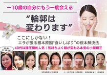 ラヴィ(Lavie)