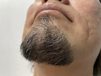 リアンジュ/肌質も毛質も問わない最新脱毛