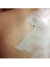 ムダ毛研究所 カンカ 銀座店(Kanka)/背中wax