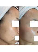 由縁/肌改善プログラム