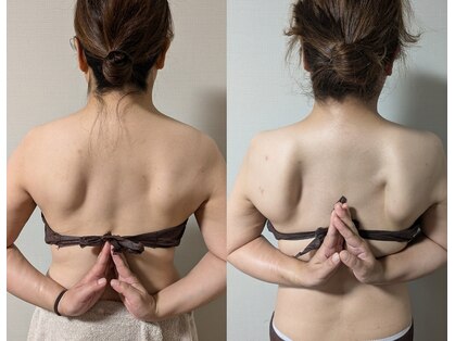 ステラリリィ(Stella Lily)の写真